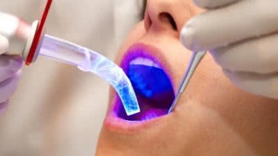 Dental therapy